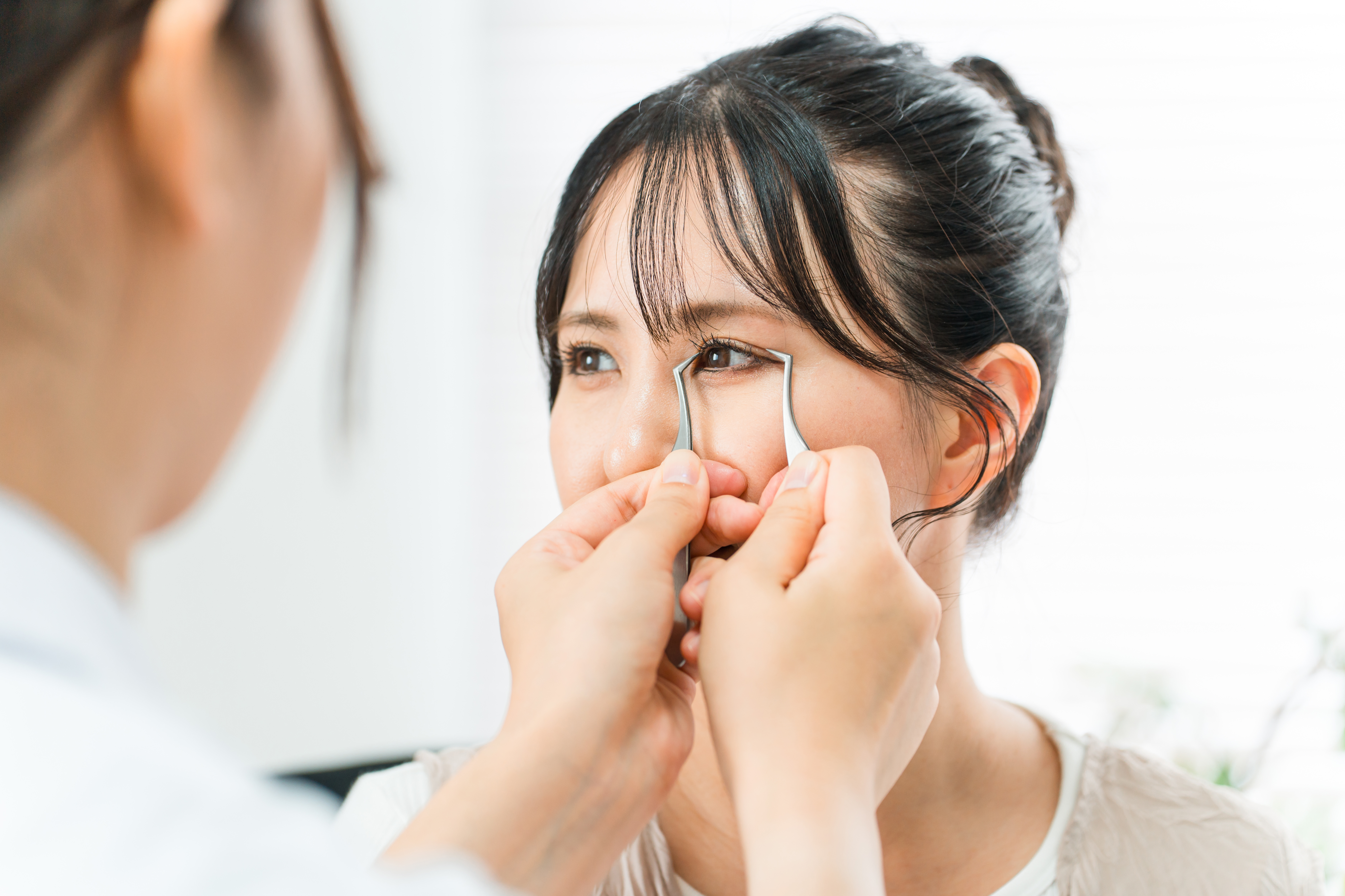 挙筋短縮術のイメージ