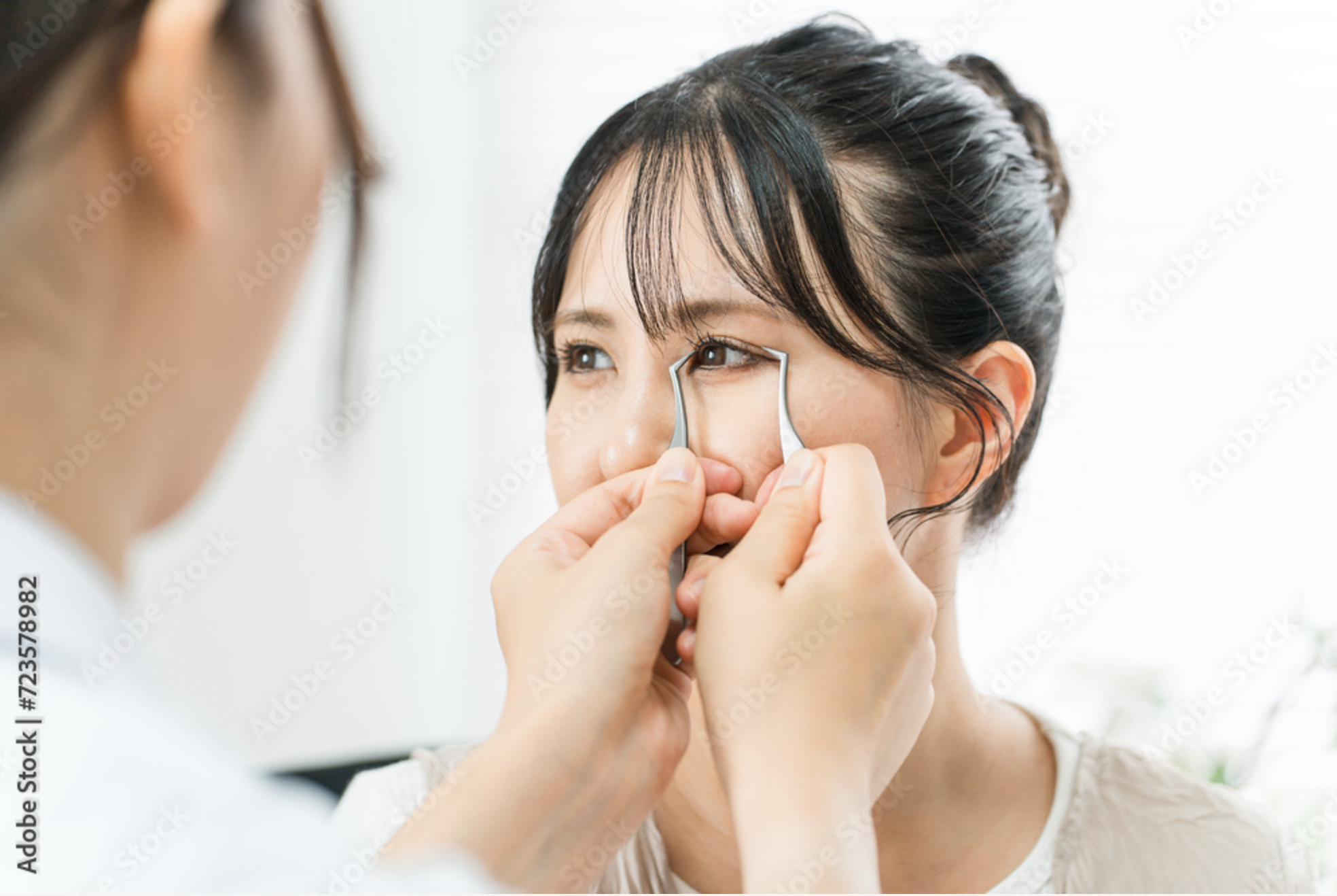 挙筋短縮術のイメージ