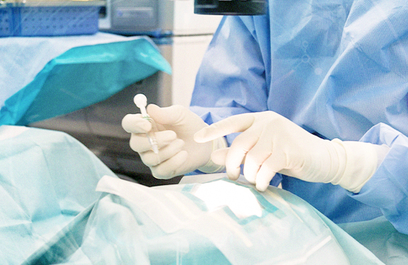 白内障手術のイメージ