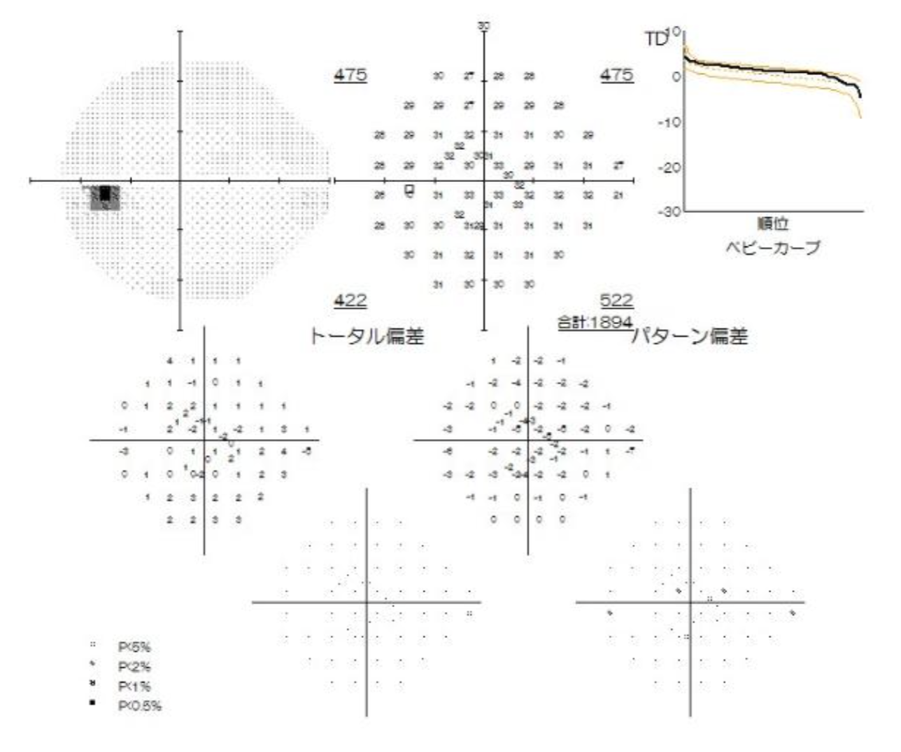 左眼