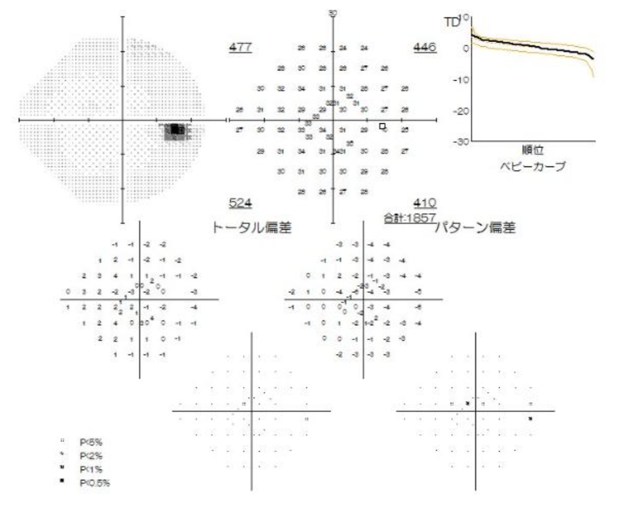 右眼
